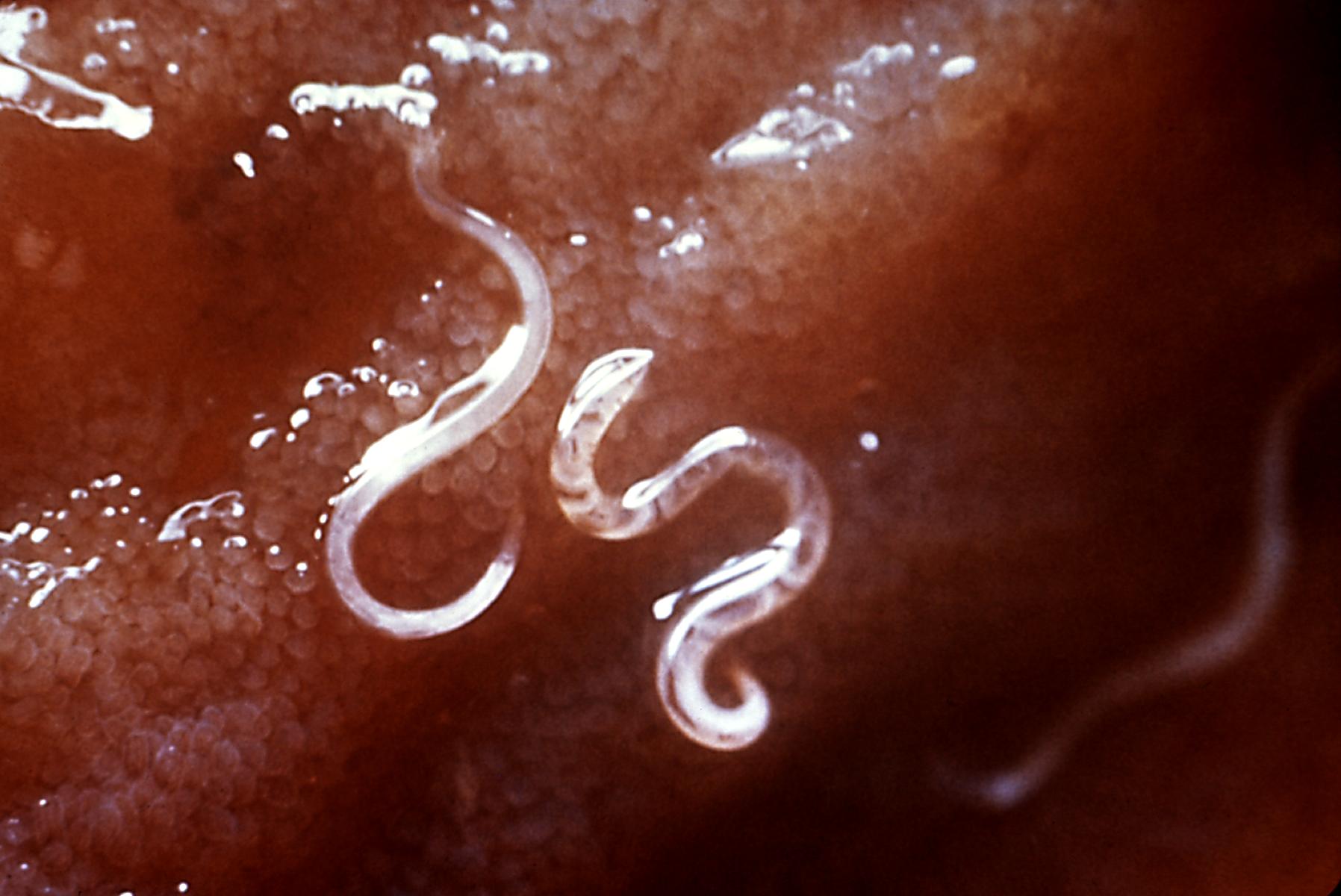 Hookworms. Transferred from en.wikipedia to Commons. This media comes from the Centers for Disease Control and Prevention's Public Health Image Library